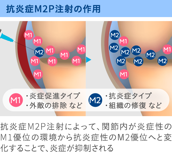 抗炎症M2P注射の作用