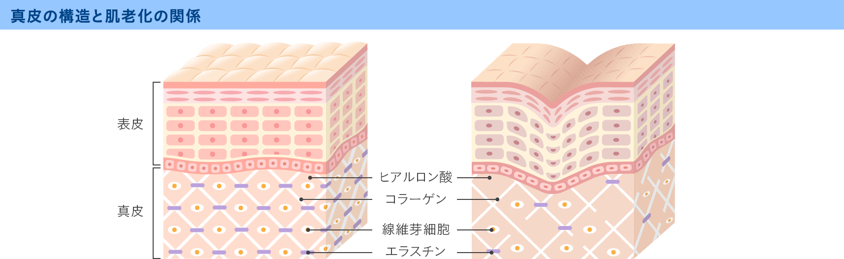 コラーゲンやエラスチンの減少