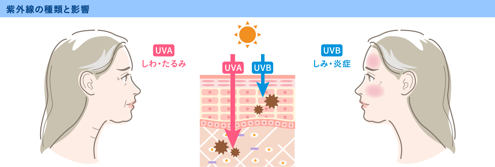 紫外線によるダメージ